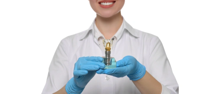 Full Mouth Dental Implants