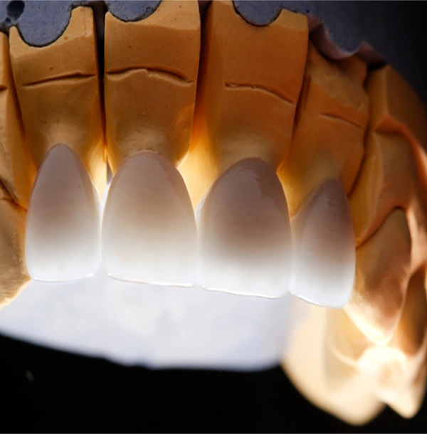 Dentures