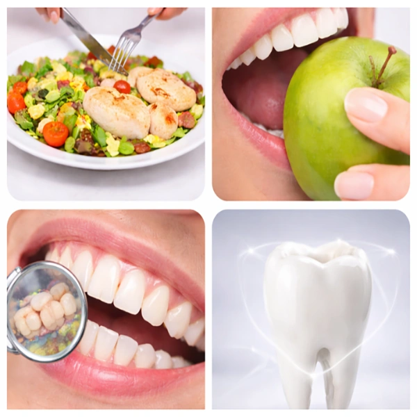 Benefits of Full Mouth Rehabilitation