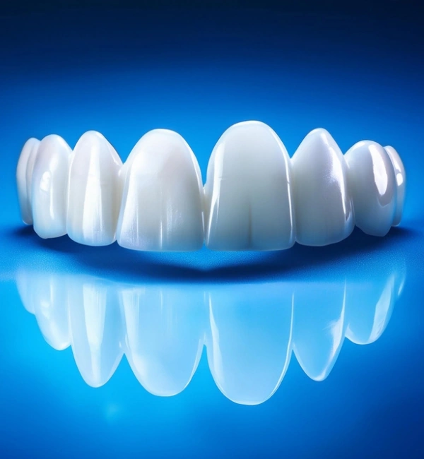 Dental Veneers