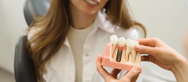 Full Mouth Dental Implants