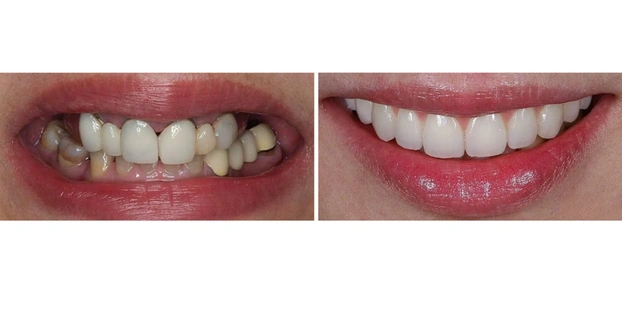 Cosmetic Dentistry