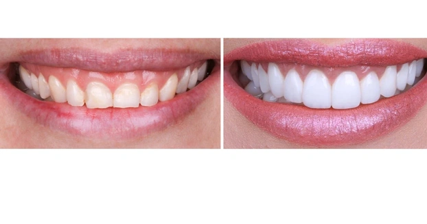 Cosmetic Dentistry