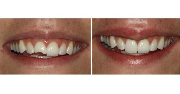 Cosmetic Dentistry