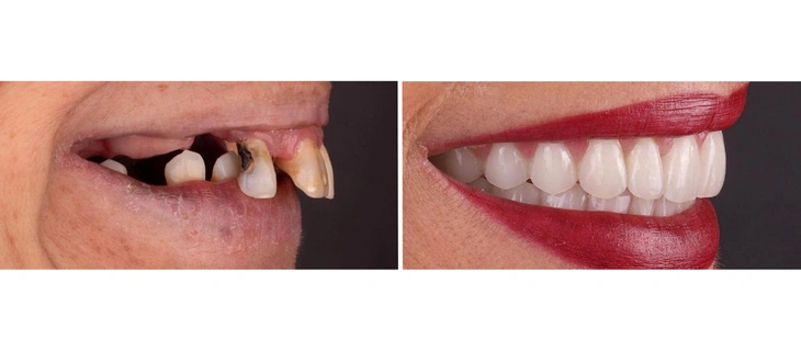 Digital Smile Design