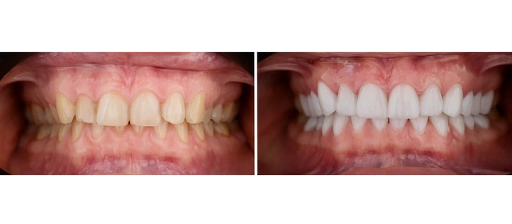 Digital Smile Design