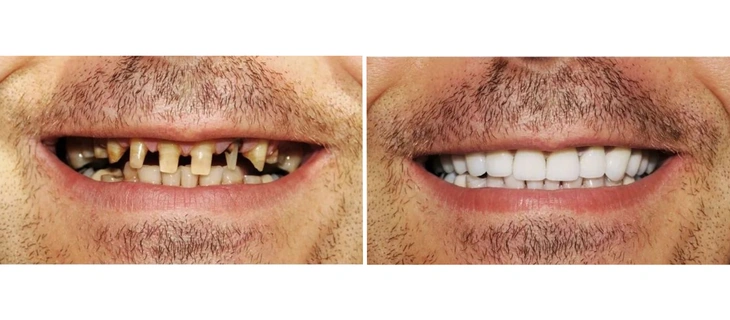 Digital Smile Design