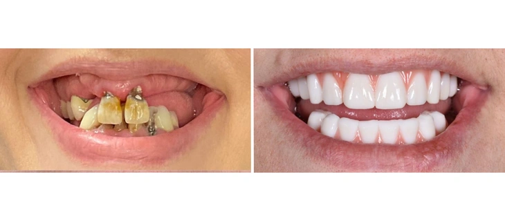 Digital Smile Design