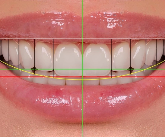 Digital Smile Design