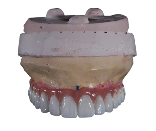 Full Mouth Rehabilitation