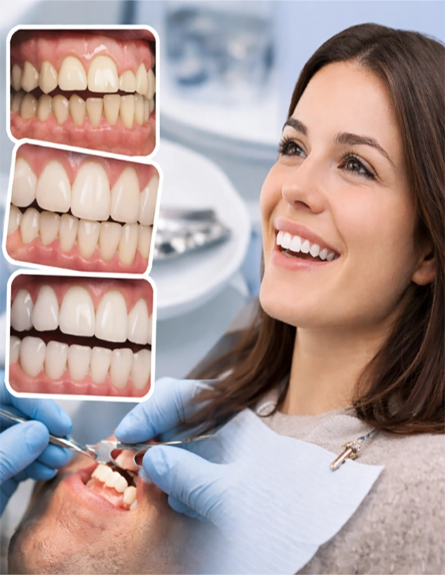 Full Mouth Rehabilitation in Bandra East