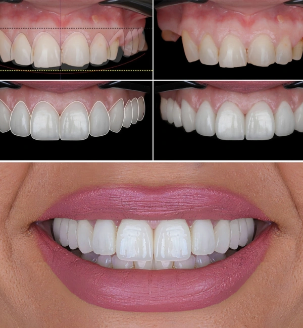 Cosmetic Dentistry