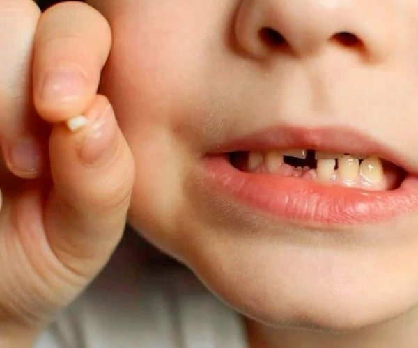 Pediatric Dentistry