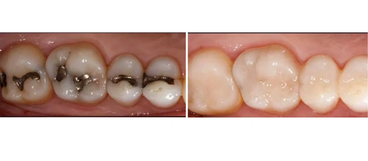 Pediatric Dentistry