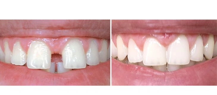 Pediatric Dentistry