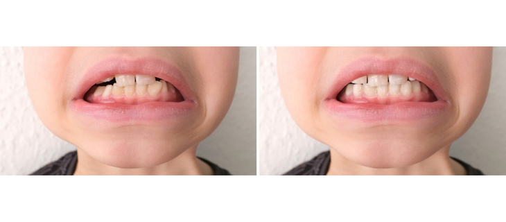 Pediatric Dentistry