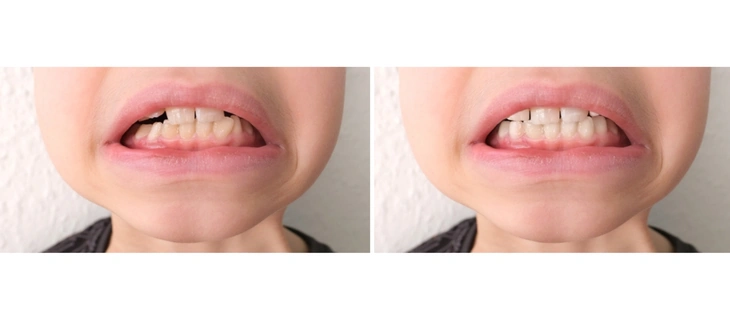 Pediatric Dentistry