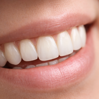 pressed-ceramic-crowns