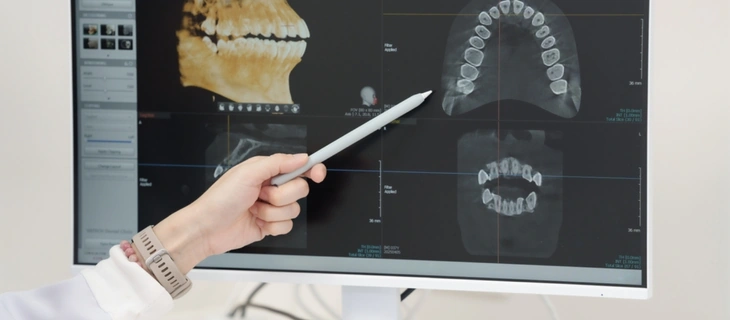Digital Smile Design