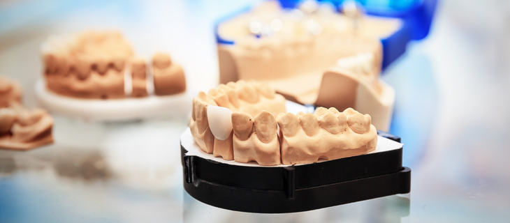 Taking Impressions and Fit Check