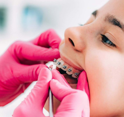 FULL MOUTH DENTAL IMPLANTS