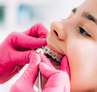 FULL MOUTH DENTAL IMPLANTS