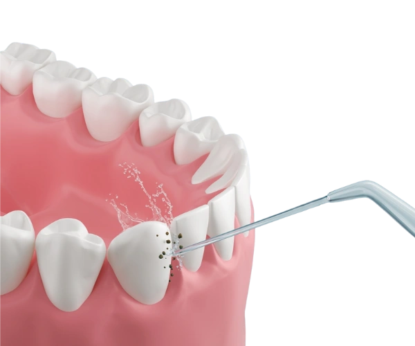 Teeth Cleaning