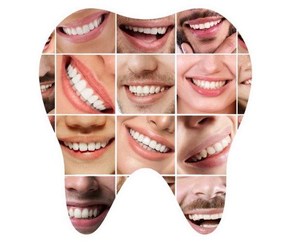 Teeth Cleaning