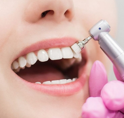 FULL MOUTH DENTAL IMPLANTS