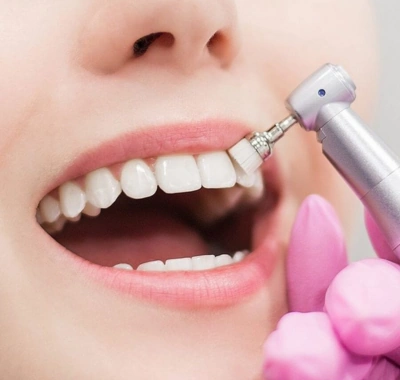 FULL MOUTH DENTAL IMPLANTS