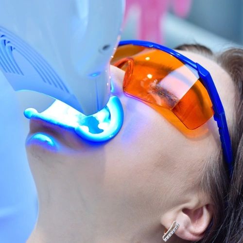 Teeth Whitening