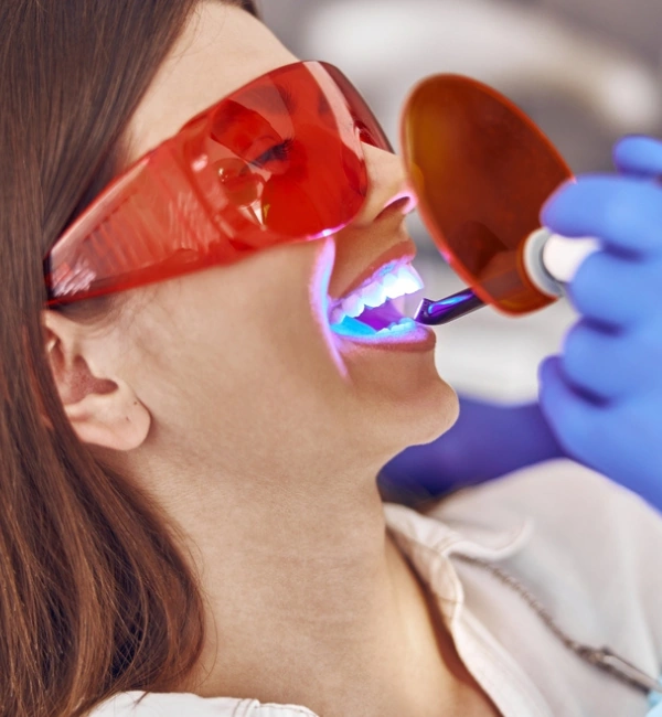 Teeth Whitening