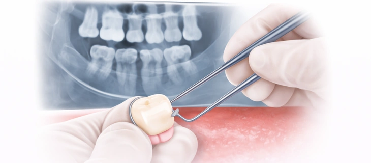 Tooth and Gum Check