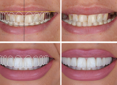 Digital Smile Design