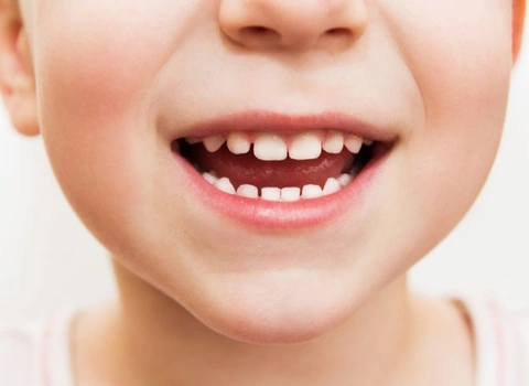 Pediatric Dentistry