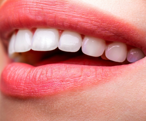 Scaling and Root Planing