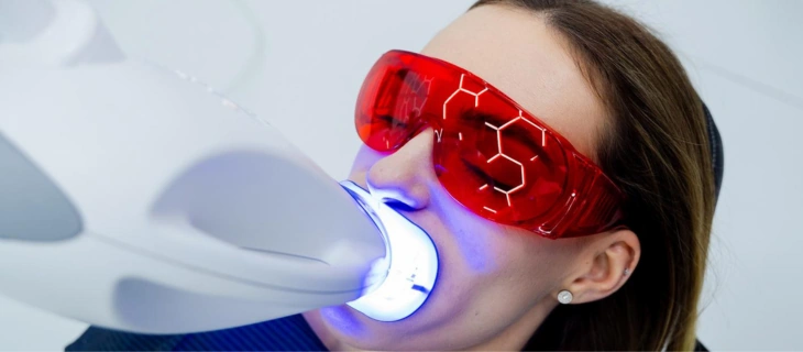 Teeth Whitening