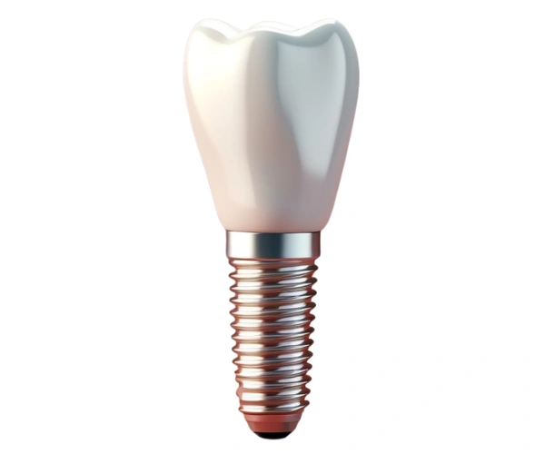 Dental Implants