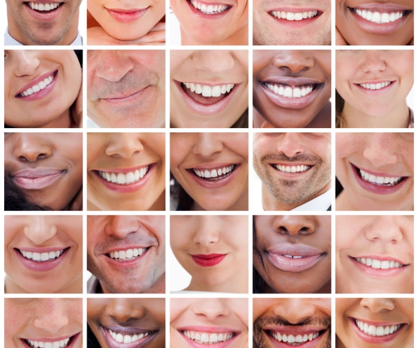 Digital Smile Designing