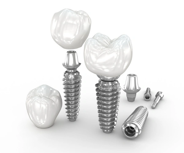 Full Mouth Dental Implants