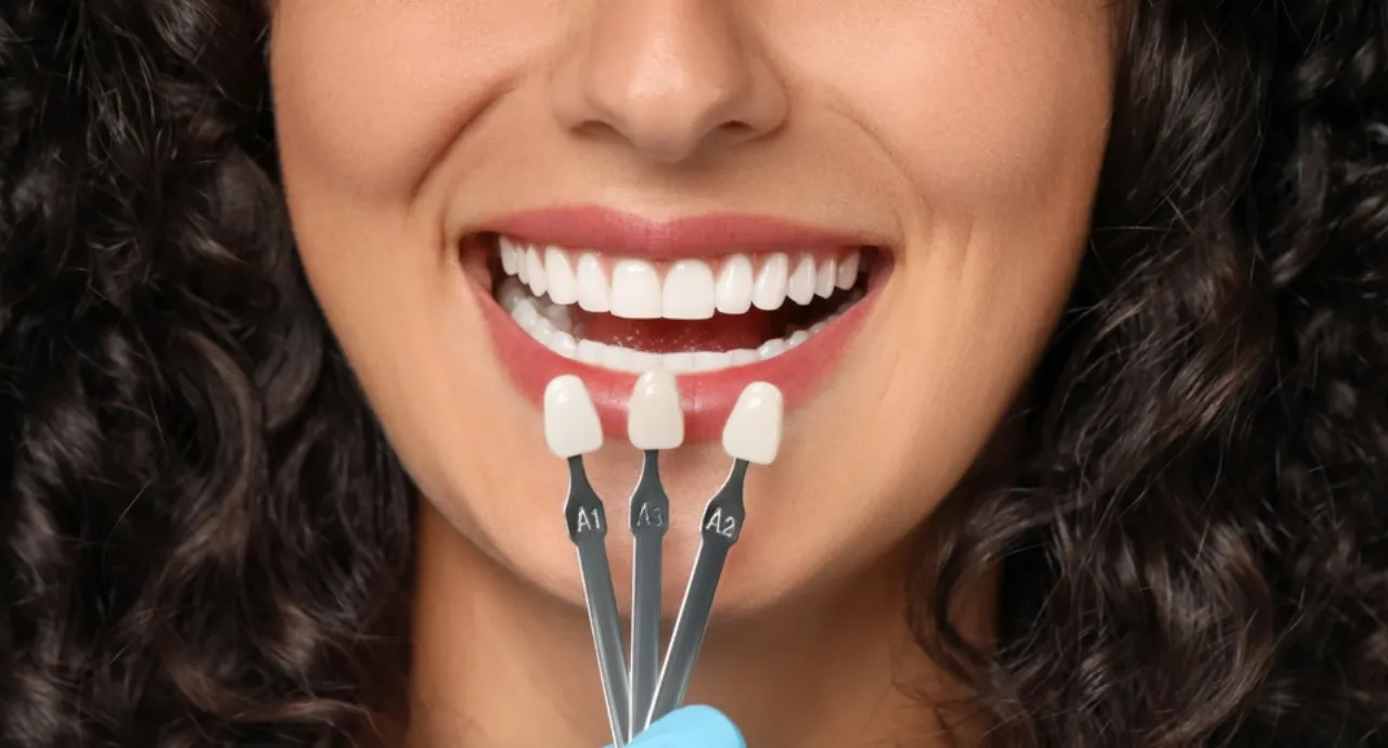 No-prep veneers treatment for a natural radiant smile at Smile Invent Dental Clinic