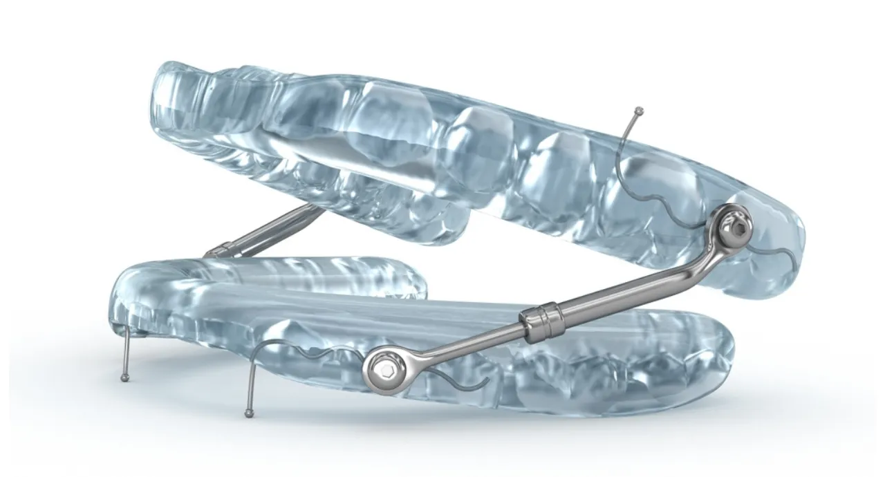 how wearable devices help prevent dental issues