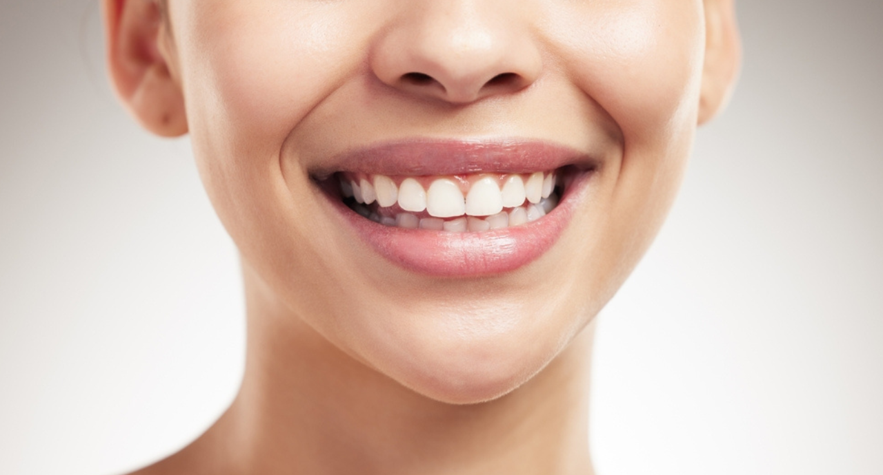 Professional Teeth Whitening Treatment