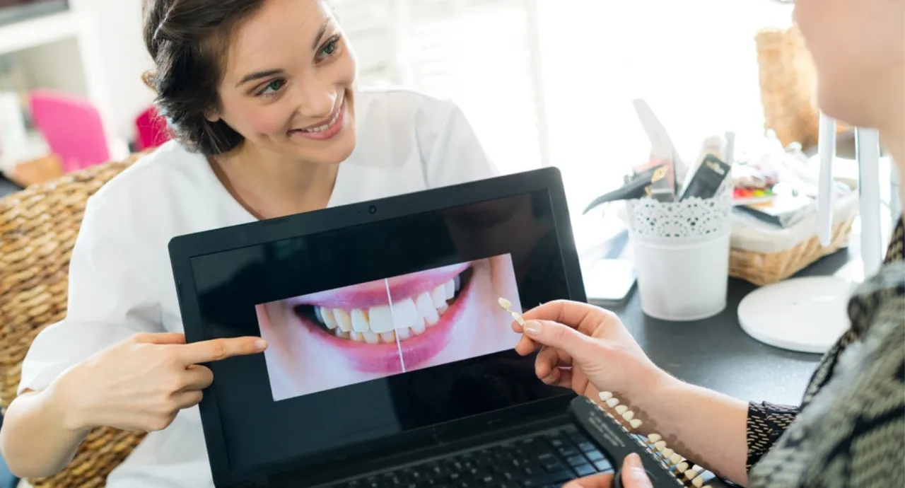 Professional teeth whitening vs at-home whitening comparison