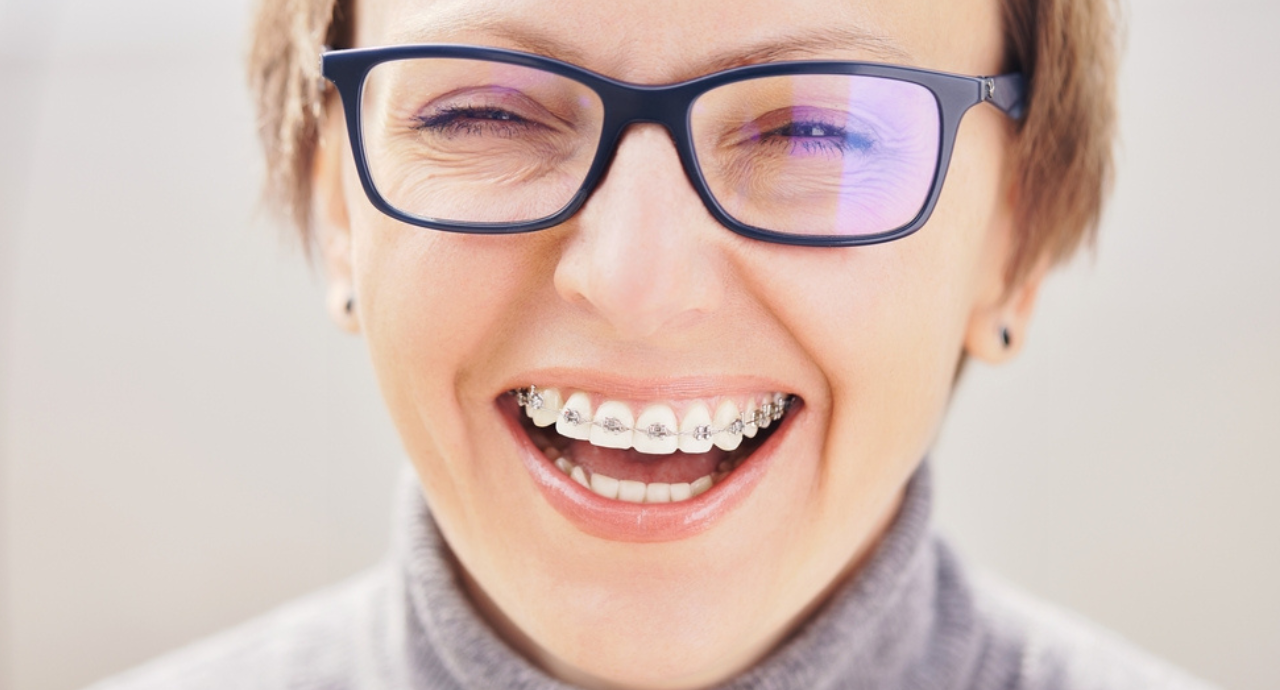 Orthodontic treatment for adults with braces and aligners