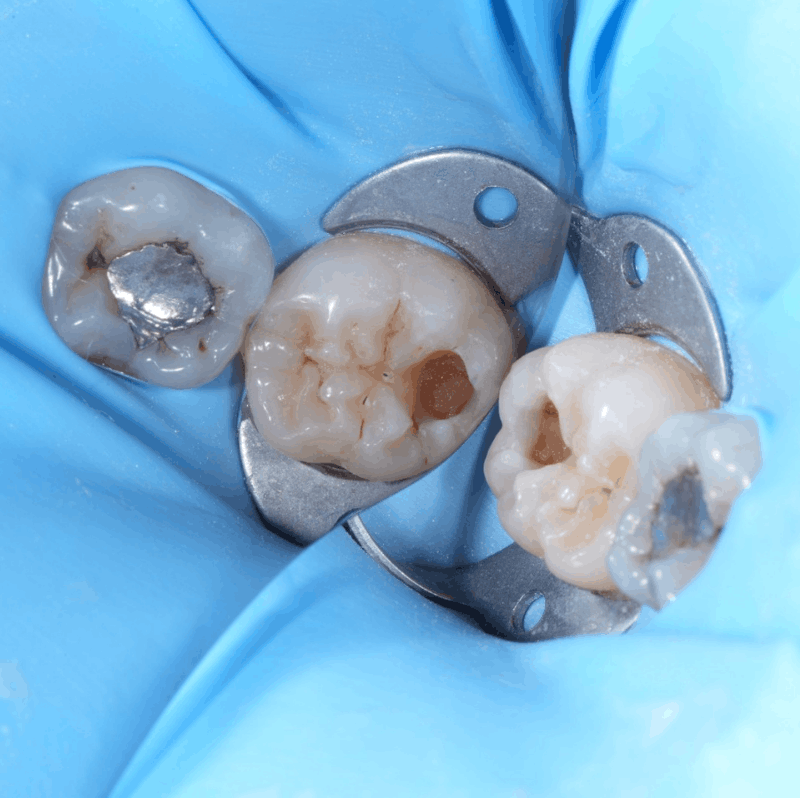 restorative dentistry